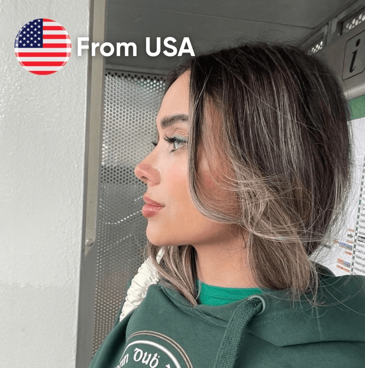 Rhinoplasty before and after